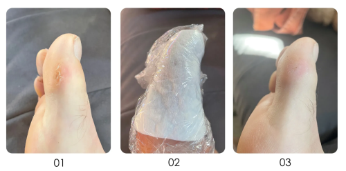 Burst_exfoliating gel (3).png
